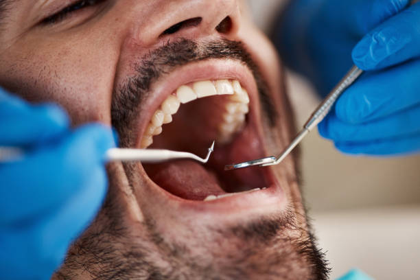 Emergency Dental Services in Carterville, MO
